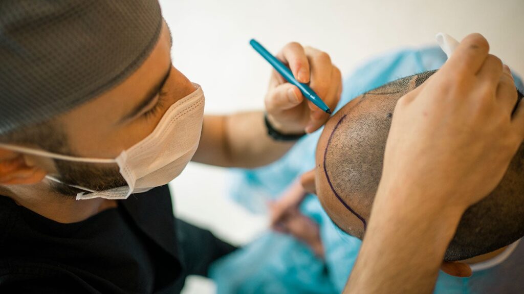 Hair Transplant Clinic in Kerala