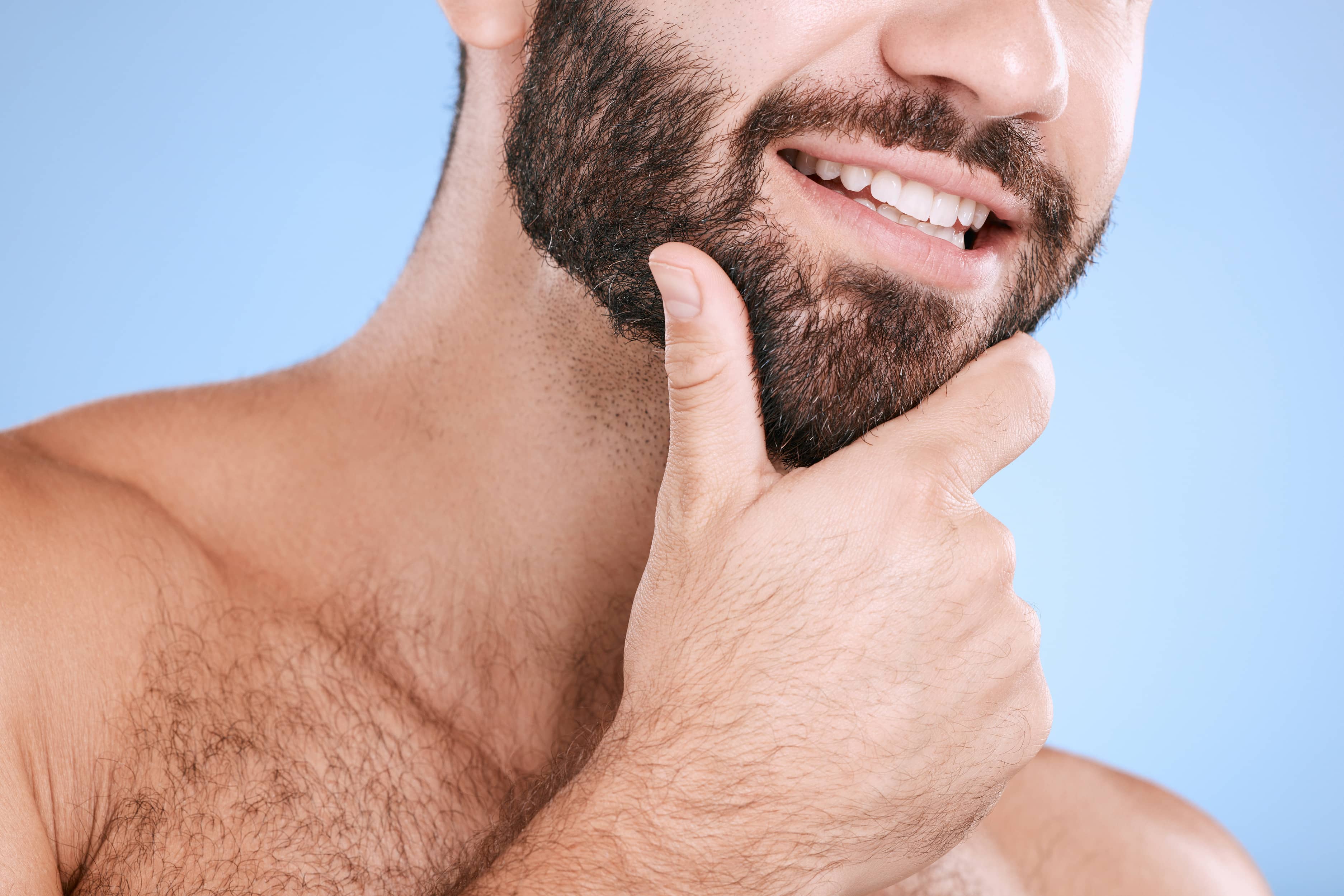Beard transplant result by BHC Hair Transplant in Kerala