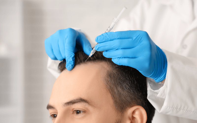 hair transplant in Kerala