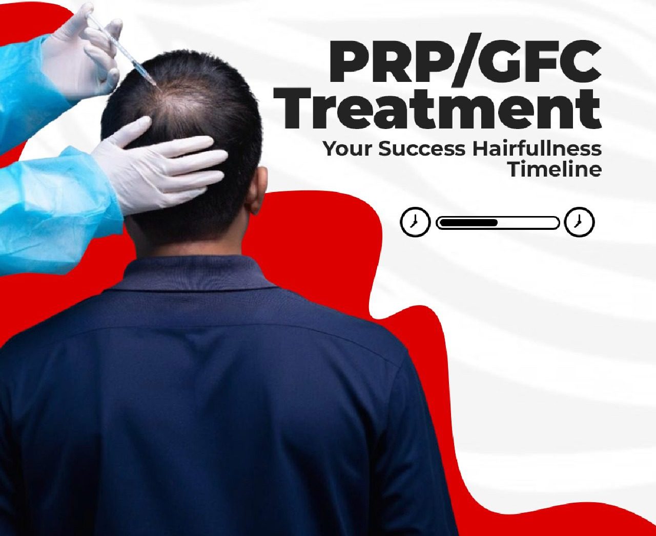 PRP Treatment in Kerala