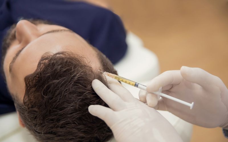 PRP Hair Treatment Cost in India