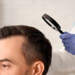 Hair Transplant in Calicut common Questions & Expert Answers img